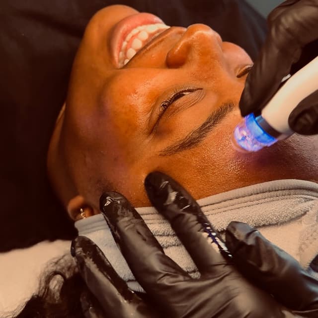 Hydrodermabrasion - 3 months at Refinery Aesthetics Loft in Oxon Hill, MD