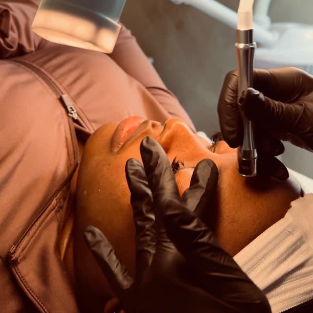 Advanced Facials - 6 months at Refinery Aesthetics Loft in Oxon Hill, MD